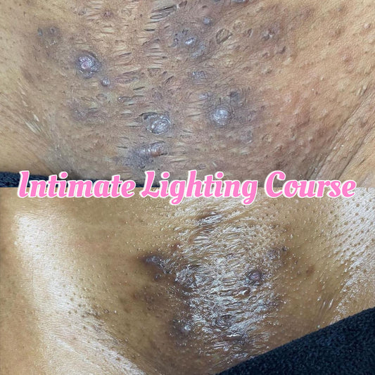 One-On-One Intimate Lighting 1 on 1 Course
