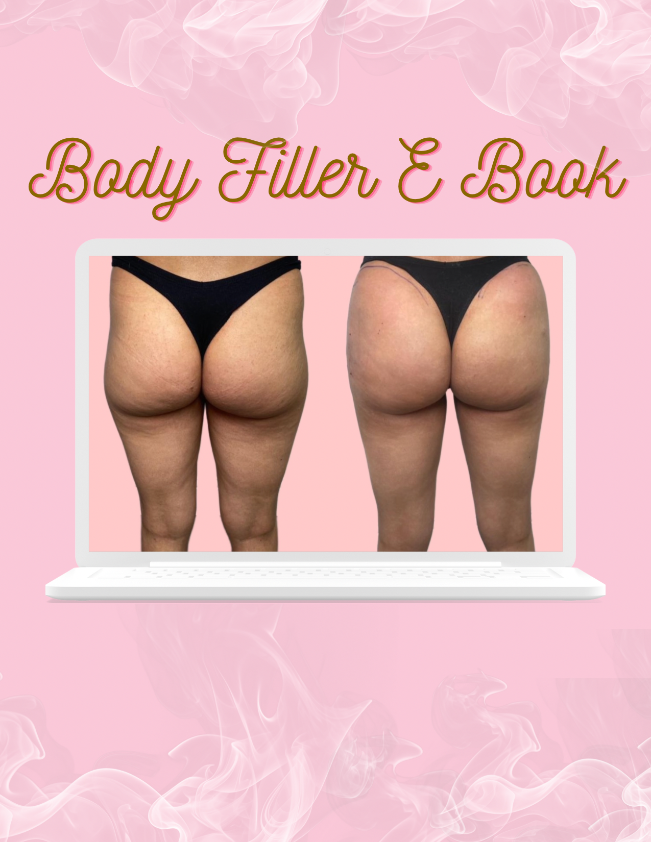 Body Fillers E-Book